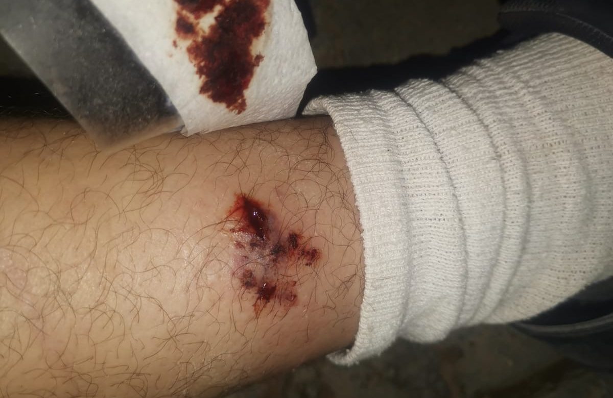Preocupación en Villas de Guadalupe por ataque de perro callejero; autoridades no responden