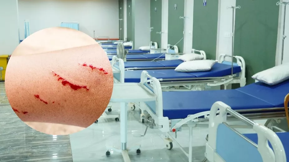 Alertan por nuevos casos sospechosos de rabia en la región
