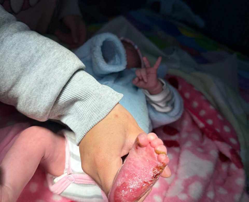 Piden justicia en Sauceda de la Borda por bebé quemada durante prueba médica